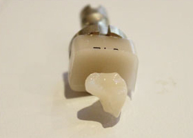 Cut into tooth with CEREC